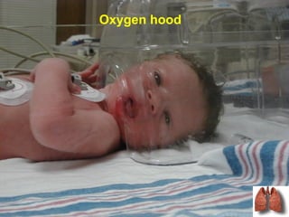 Oxygen hood
 