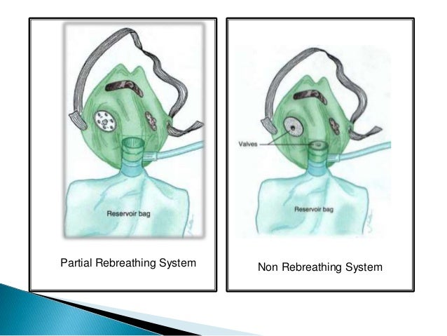 Oxygen therapy
