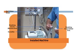 Installed Machine
Humidifier
Breathing
Circuit
(Machine End)
Distill Water
Bottle
Breathing
Circuit (Distal
End)
 