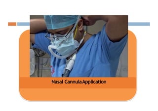 Nasal CannulaApplication
 