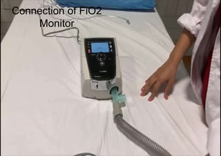 Connection of FiO2
Monitor
 