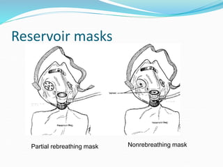 Reservoir masks
Partial rebreathing mask Nonrebreathing mask
 