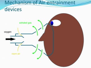 Mechanism of Air entrainment
devices
oxygen
room air
exhaled gas
 