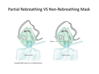 Partial Rebreathing VS Non-Rebreathing Mask
 
