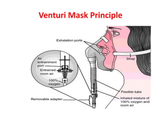 Venturi Mask Principle
 