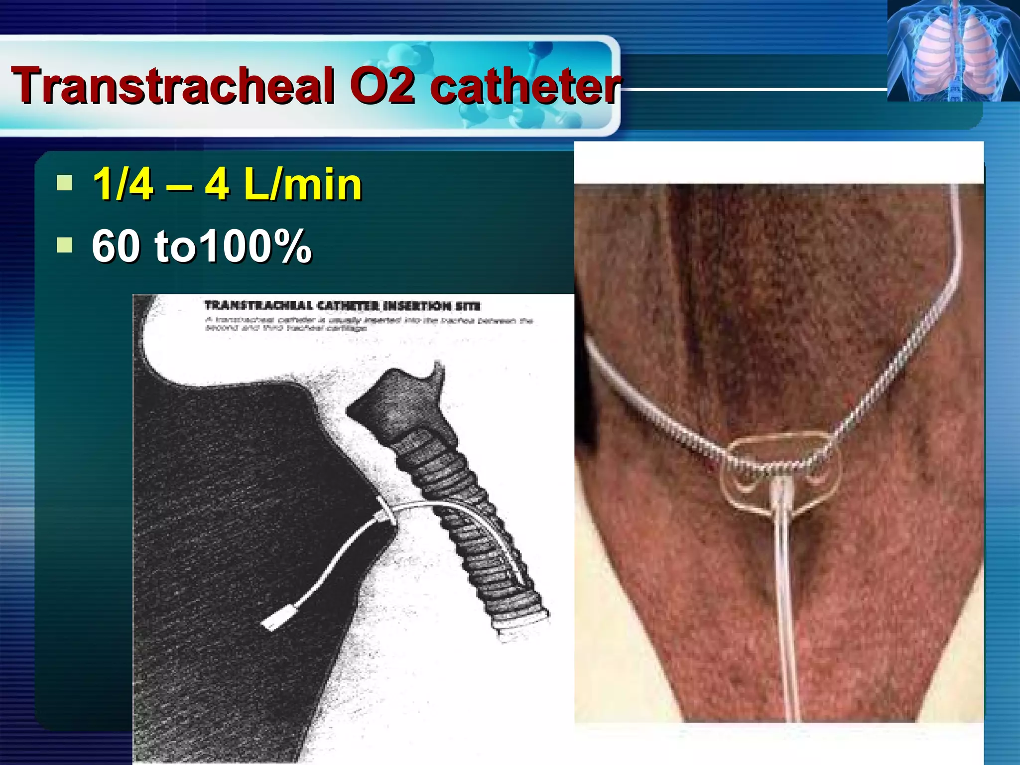 Transtracheal O2 catheter 1/4 – 4 L/min 60 to100%   