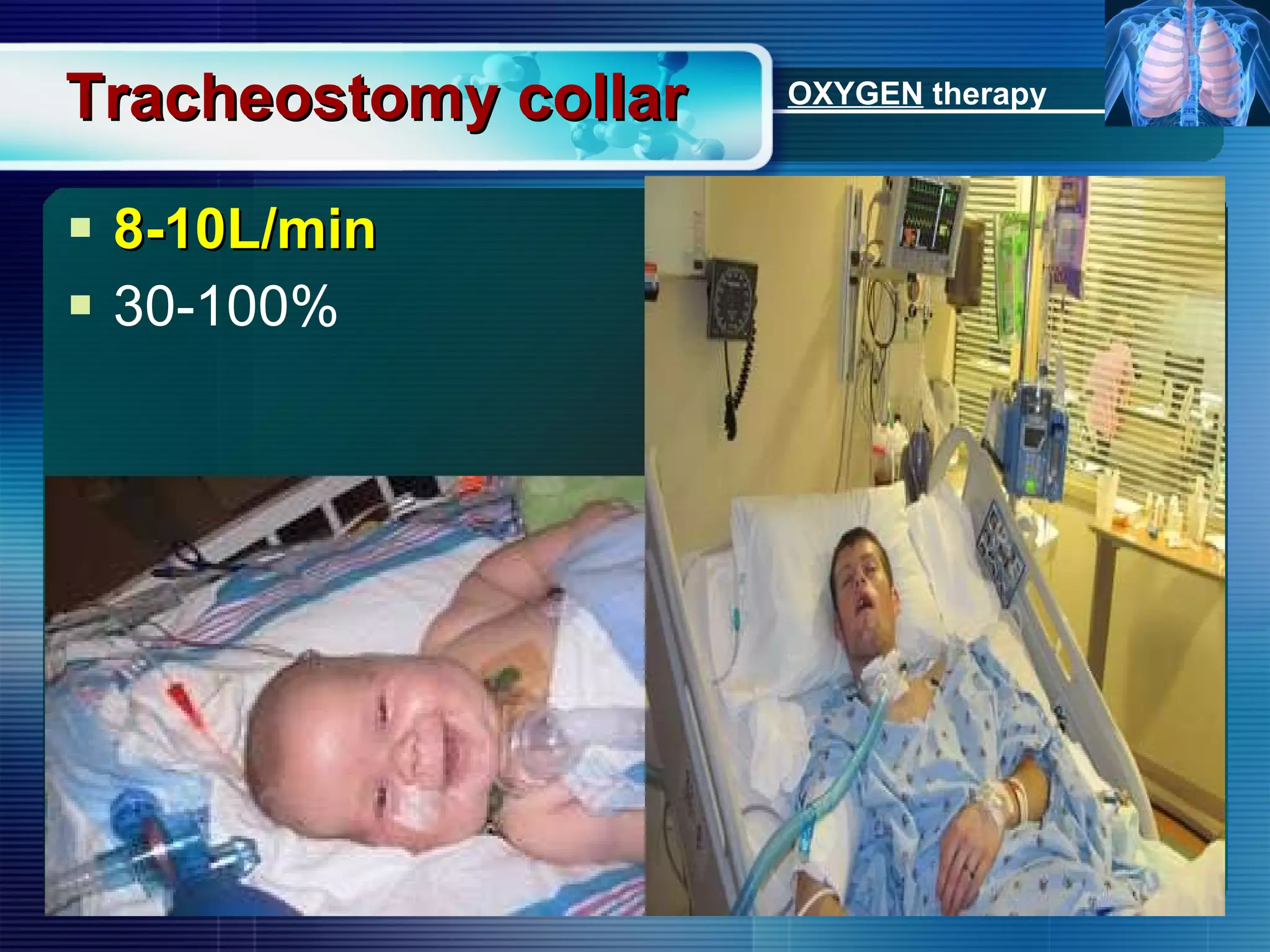 Tracheostomy collar 8-10L/min 30-100% OXYGEN  therapy 