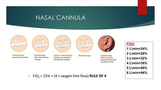 NASAL CANNULA
• FiO2 = 21% + (4 × oxygen litre flow) RULE OF 4
 
