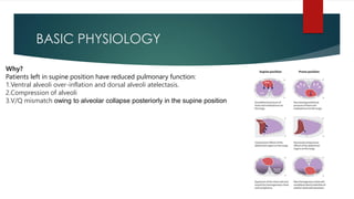 BASIC PHYSIOLOGY
Why?
Patients left in supine position have reduced pulmonary function:
1.Ventral alveoli over-inflation and dorsal alveoli atelectasis.
2.Compression of alveoli
3.V/Q mismatch owing to alveolar collapse posteriorly in the supine position
 
