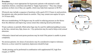 Procedure
Awake proning is most appropriate for hypoxemic patients with minimal or mild
respiratory distress, sometimes described as “happy hypoxemics.” They may change
positions on their own if they are capable, which may help limit exposure to HCWs.
•Protocols may include a sequence of positions with a goal of 0.5-2 hours in each position,
but patients may alter position based on comfort. They may remain non-supine for up to
16-18 hours daily.
•Reverse trendelenberg 10-20 degrees may be useful in reducing pressure on the thorax
from the abdomen and improving venous return thus reducing facial/eyelid edema
•Foam cushions or partially-filled saline bags may be used for additional padding in areas
as the face, sternal area, hips, knees etc. • Eye protection may be used to help avoid corneal
abrasions.
•Alternative lateral and semi-prone positions may be tried if the patient is unable to prone
completely.
•In anxious patients, low doses of anxiolytics may be considered to improve tolerance.
However, a close watch for respiratory depression should be kept
Awake proning can be performed in combination with supplemental O2, high flow
oxygen, or NIPPV.
 