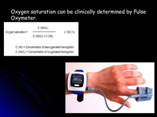 Oxygen saturation can be clinically determined by Pulse
Oxymeter.
 