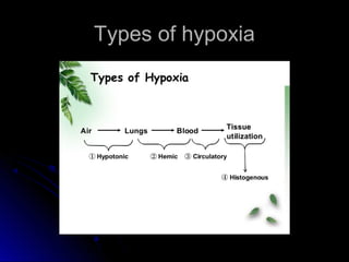 Types of hypoxiaTypes of hypoxia
 