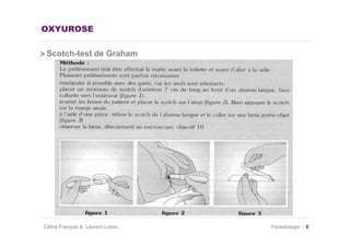 OXYUROSE

 Scotch-test de Graham




Céline François & Laurent Lokiec   Parasitologie   6
 