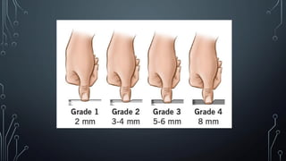 Edema and it's types ( presentation ) medicine | PDF