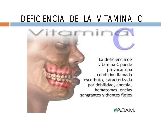 Imagen relacionada