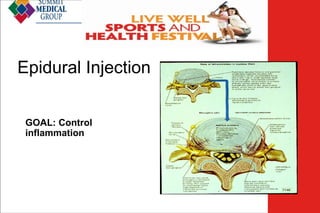 Low Back
Pain

Epidural Injection
GOAL: Control
inflammation

 