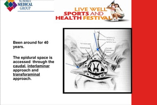 Epidural Injection

Been around for 40
years.
The epidural space is
accessed through the
caudal, interlaminar
approach and
transforaminal
approach.

Low Back
Pain

 