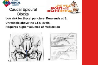Caudal Epidural
Blocks

Low Back
Pain

Low risk for thecal puncture. Dura ends at S2.
Unreliable above the L4-5 levels.
Requires higher volumes of medication

 