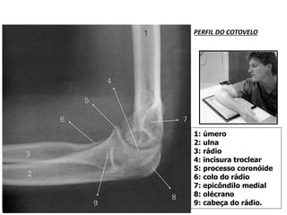 ANATOMIA Anatomia Radiologica pptx anatomia-anatomia-radiologica-pptx