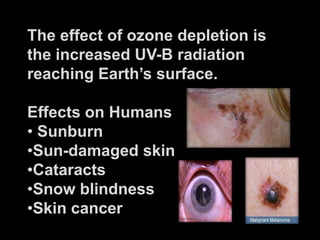 The effect of ozone depletion is
the increased UV-B radiation
reaching Earth’s surface.

Effects on Humans
• Sunburn
•Sun-damaged skin
•Cataracts
•Snow blindness
•Skin cancer
 