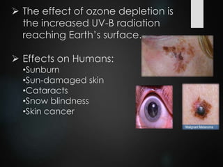  The effect of ozone depletion is
the increased UV-B radiation
reaching Earth’s surface.
 Effects on Humans:
•Sunburn
•Sun-damaged skin
•Cataracts
•Snow blindness
•Skin cancer
 