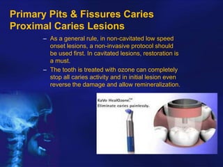 Primary Pits & Fissures Caries
Proximal Caries Lesions
– As a general rule, in non-cavitated low speed
onset lesions, a non-invasive protocol should
be used first. In cavitated lesions, restoration is
a must.
– The tooth is treated with ozone can completely
stop all caries activity and in initial lesion even
reverse the damage and allow remineralization.

 