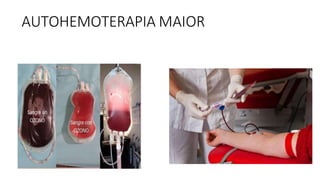 AUTOHEMOTERAPIA MAIOR
 