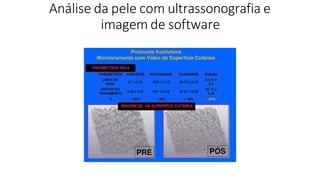 Análise da pele com ultrassonografia e
imagem de software
 
