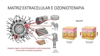 MATRIZ EXTRACELULAR E OZONIOTERAPIA
 