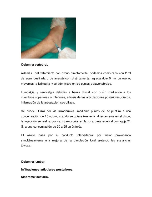 El tratamiento de la columna vertebral en ufe