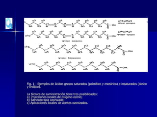 Fig. 1 - Ejemplos de ácidos grasos saturados (palmítico y esteárico) e insaturados (oleico
y linólico).
La técnica de suministración tiene tres posibilidades:
a) Inyecciones locales de oxígeno-ozono;
b) Balneoterapia ozonizada;
c) Aplicaciones locales de aceites ozonizados.
 