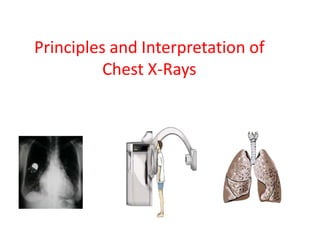 Principles and Interpretation of
Chest X-Rays
 