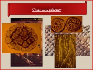 Teste aos pólenes
 