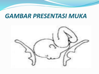 GAMBAR PRESENTASI MUKA
 