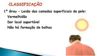 CLASSIFICAÇÃO
1º Grau - Lesão das camadas superficiais da pele:
Vermelhidão
Dor local suportável
Não há formação de bolhas
 
