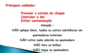 Principais cuidados:
Prevenir o estado de choque
Controlar a dor
Evitar contaminação
Atenção :
NÃO aplique óleos, loções ou outras substâncias em
queimaduras externas
NÃO retire nada aderido na queimadura
NÃO fure as bolhas
NÃO toque na queimadura
 