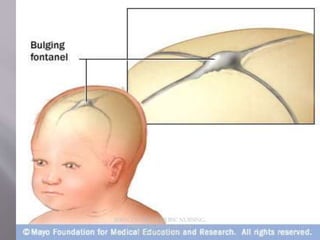 JERIN.T.S, 3RD YEAR BSC NURSING,
KRSMCON MANGALORE.
PH:+919496743672