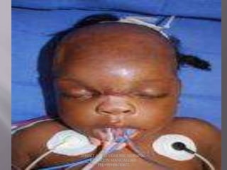 JERIN.T.S, 3RD YEAR BSC NURSING,
KRSMCON MANGALORE.
PH:+919496743672