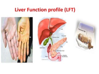 Liver Function profile (LFT)
 