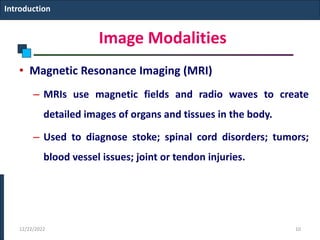 Image Modalities
• Magnetic Resonance Imaging (MRI)
– MRIs use magnetic fields and radio waves to create
detailed images of organs and tissues in the body.
– Used to diagnose stoke; spinal cord disorders; tumors;
blood vessel issues; joint or tendon injuries.
Introduction
12/22/2022 10
 