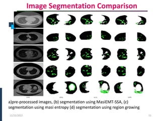 Image Segmentation Comparison
PHASE -I
12/22/2022 51
(a) (b) (c) (d)
a)pre-processed images, (b) segmentation using MasiEMT-SSA, (c)
segmentation using masi entropy (d) segmentation using region growing
 