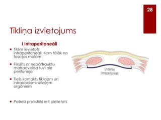 28

Tīkliņa izvietojums
I Intraperitoneāli
 Tīkliņs ievietots
intraperitoneāli, 4cm tālāk no
fascijas malām
 Fiksēts ar nepārtrauktu
matracveida šuvi pie
peritoneja
 Tiešs kontakts tīkliņam un
intraabdominālajiem
orgāniem

 Pašreiz prakstiski reti pielietots

 