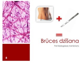 Brūces dzīšana
Pat.fiziologiskais mehānisms

8

 