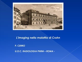 L’imaging nella malattia di Crohn P. CERRO U.O.C. RADIOLOGIA PNRM – ROMA - 