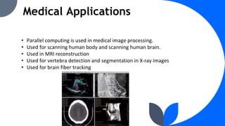 Medical Applications
• Parallel computing is used in medical image processing.
• Used for scanning human body and scanning human brain.
• Used in MRI reconstruction
• Used for vertebra detection and segmentation in X-ray images
• Used for brain fiber tracking
 