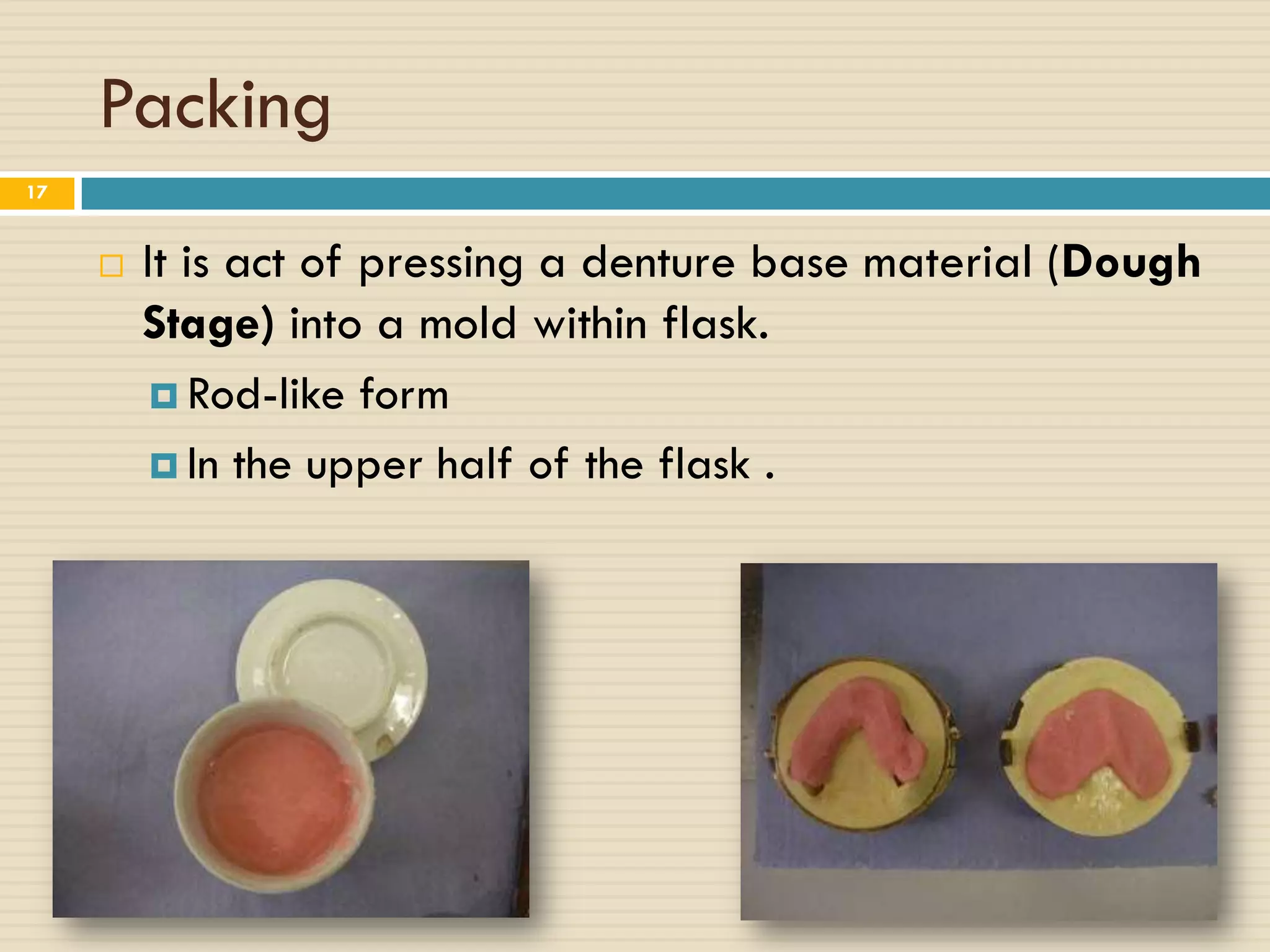 Packing
17


        It is act of pressing a denture base material (Dough
         Stage) into a mold within flask.
           Rod-like form

           In the upper half of the flask .
 