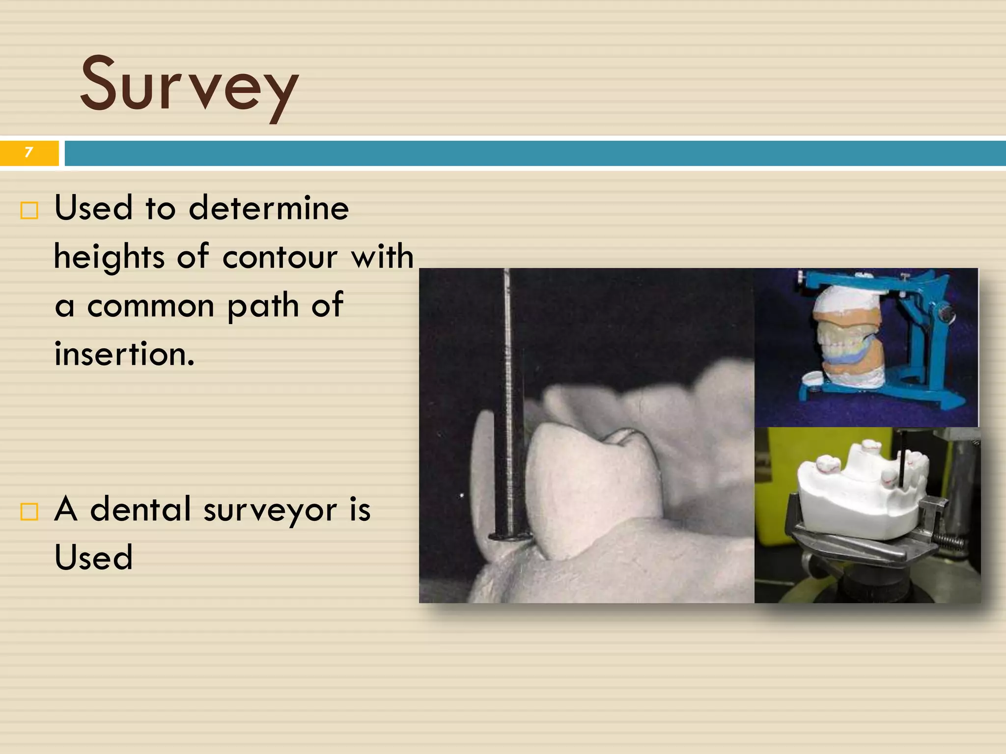 Survey
7


   Used to determine
    heights of contour with
    a common path of
    insertion.


   A dental surveyor is
    Used
 