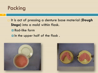 Packing
17


        It is act of pressing a denture base material (Dough
         Stage) into a mold within flask.
           Rod-like form

           In the upper half of the flask .
 