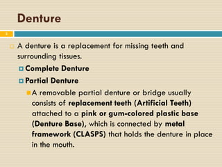 denture removeable