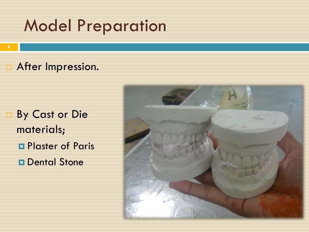 Removeable Partial Denture Steps